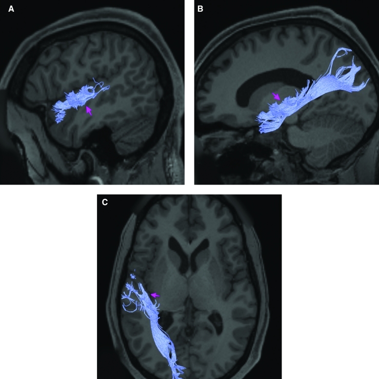 FIGURE 42.