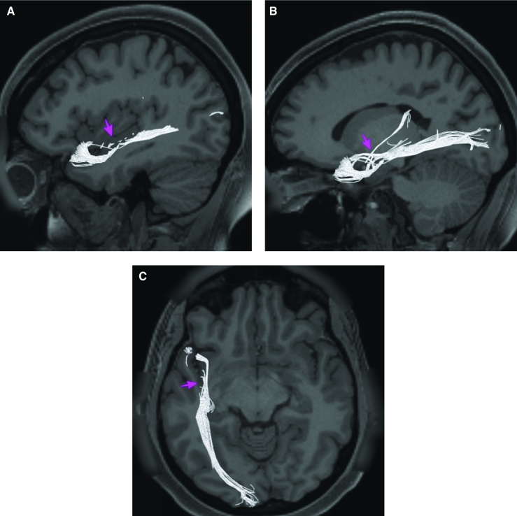 FIGURE 58.