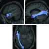 FIGURE 64.