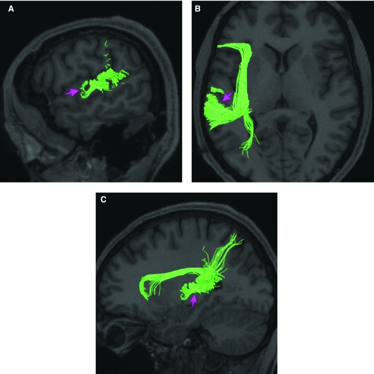 FIGURE 46.