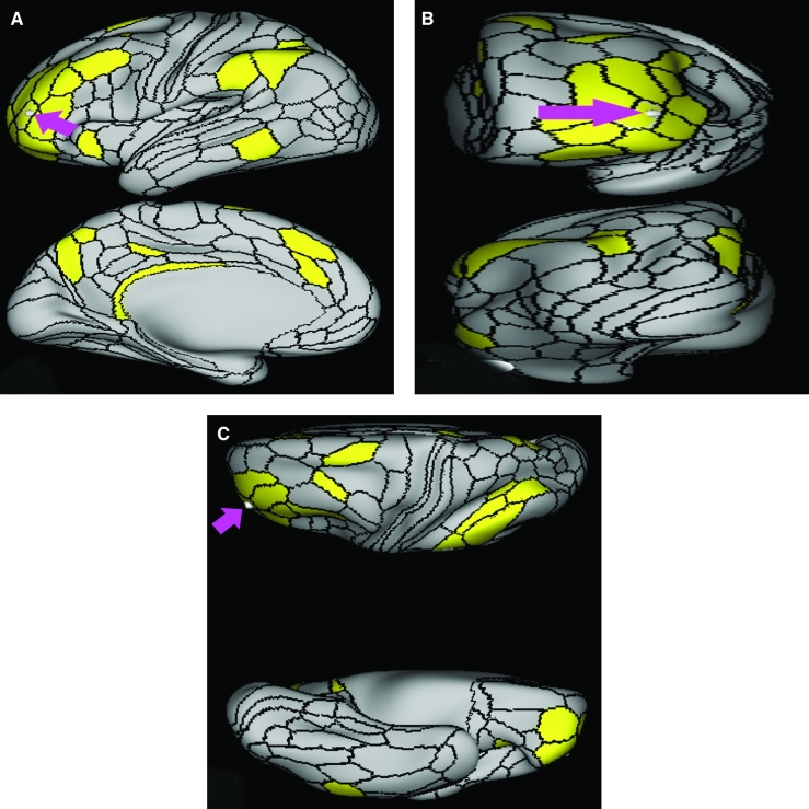 FIGURE 61.