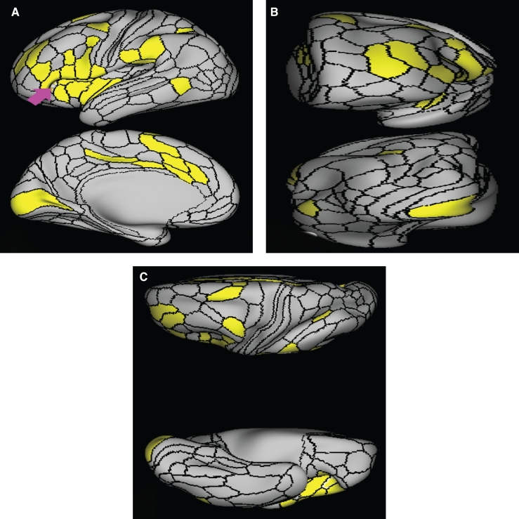 FIGURE 11.