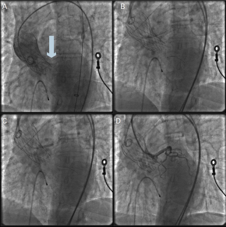 Figure 4: