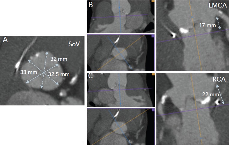 Figure 2: