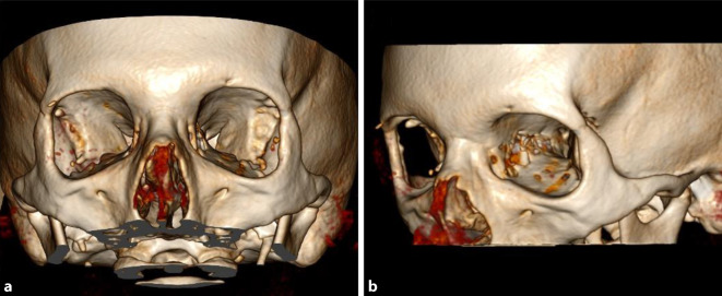 graphic file with name 347_2020_1181_Fig3_HTML.jpg