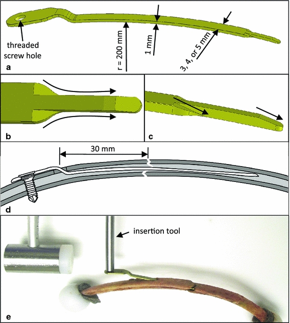 Fig. 4