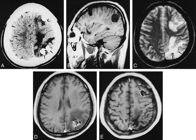 fig 2.