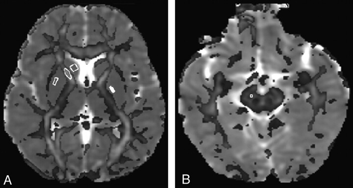 Fig 1.