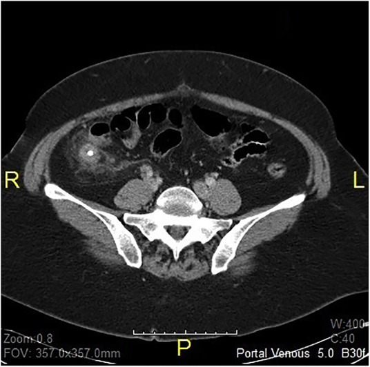 Figure 1