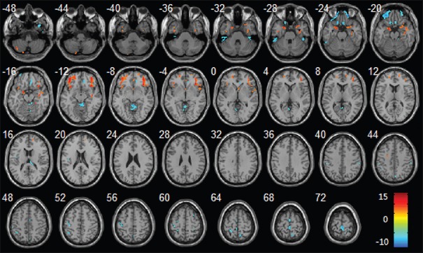 Figure 12