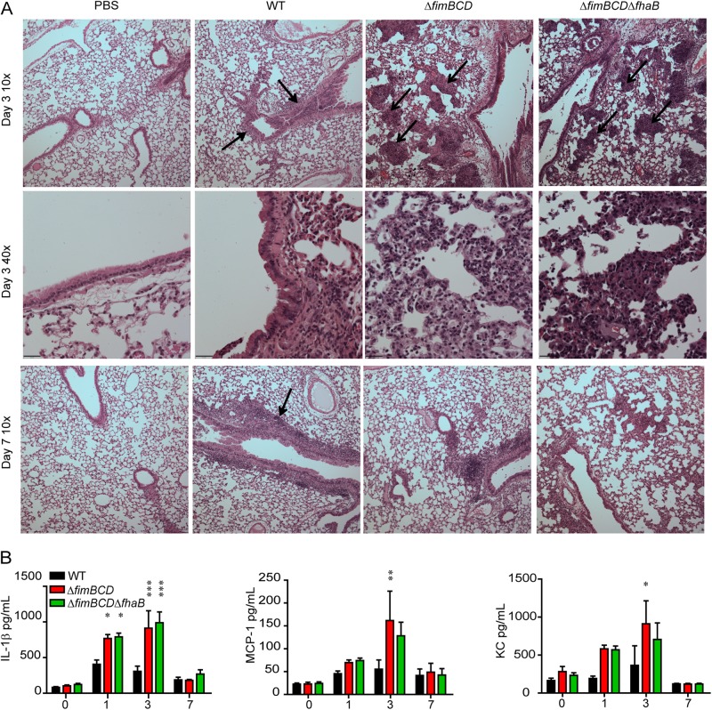 FIG 3 