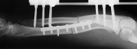 Fig. 14