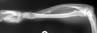 Fig. 13