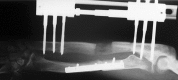 Fig. 15