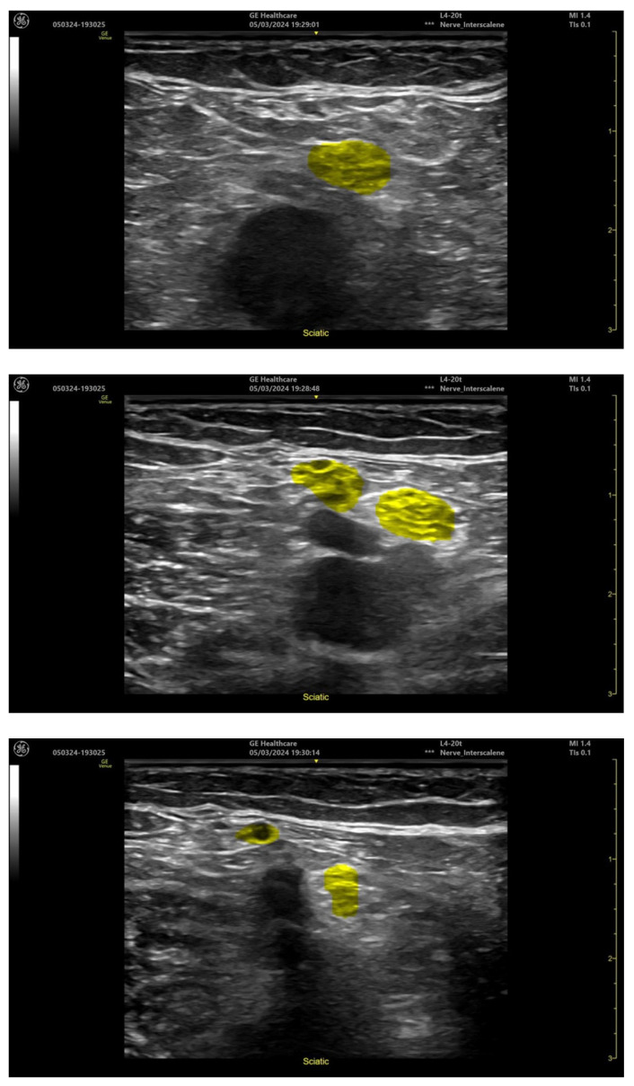 Figure 12