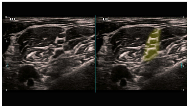 Figure 13