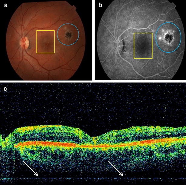 Fig. 1