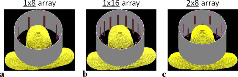 FIG. 1