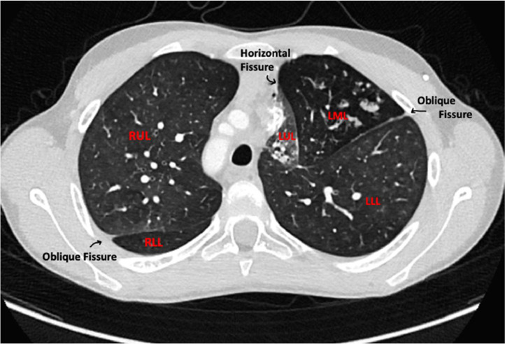 Fig 3