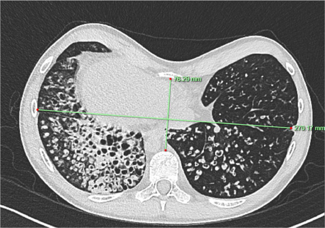 Fig 5