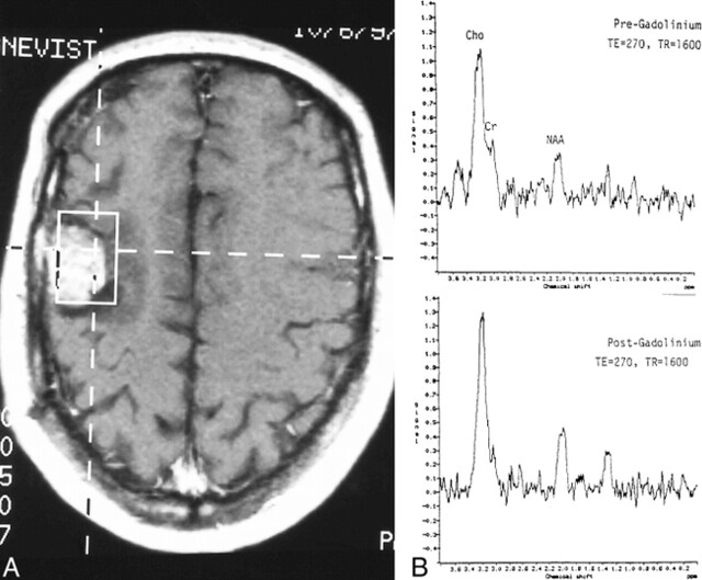 fig 3.