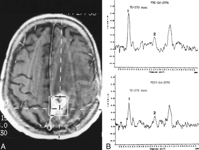 fig 4.