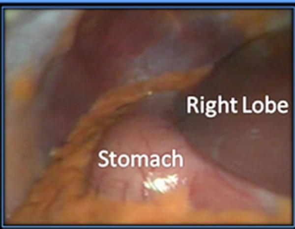 Figure 5