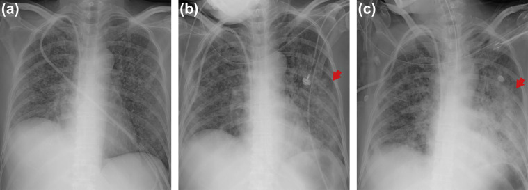 Fig. 3