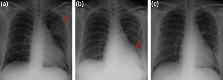 Fig. 2