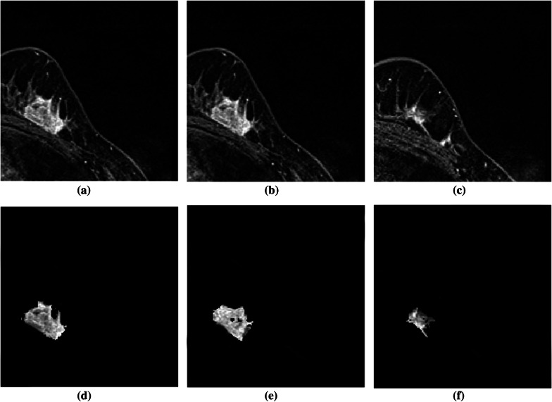Fig. 12