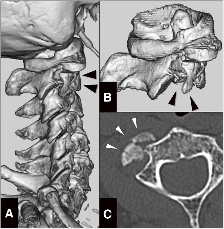 Fig. 1