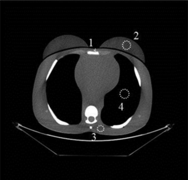 Fig. 3