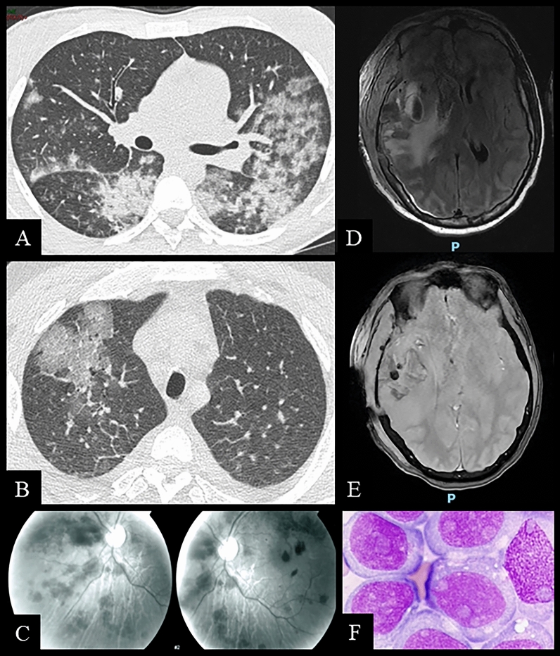 Fig. 1