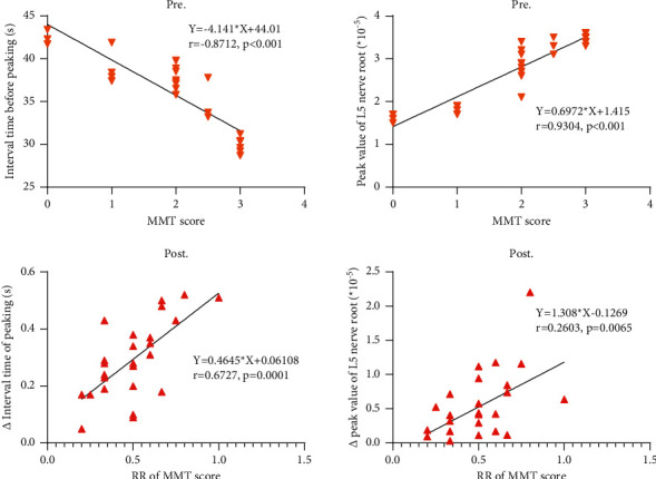 A Novel Capsule Lumbar Interbody Fusion (clif) In Treating Foot Drop 