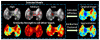 Fig. 14