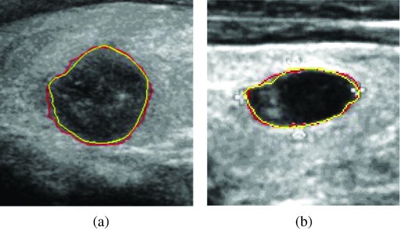 FIG. 13.