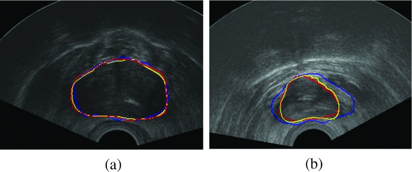 FIG. 10.