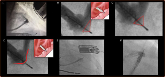 Figure 3: