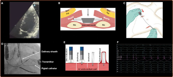 Figure 2: