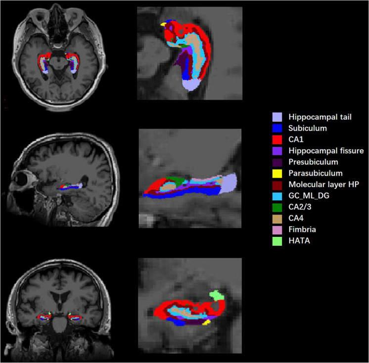 FIGURE 1