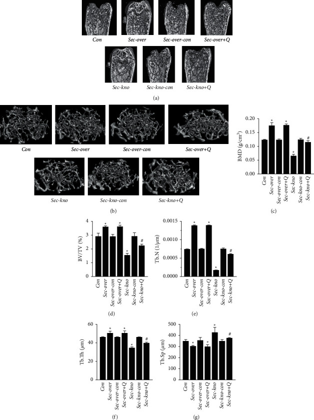 QiangGuYin Modulates The OPG RANKL RANK Pathway By Increasing Secretin Levels During Treatment