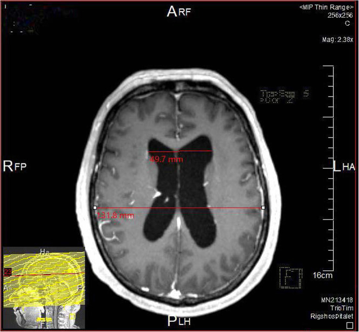 Fig. 1