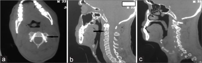 Figure 3: