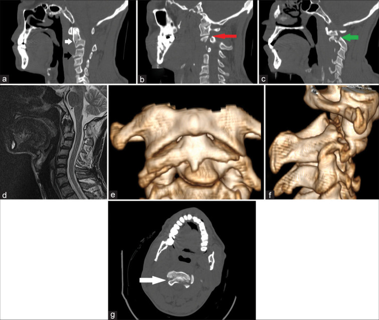 Figure 1: