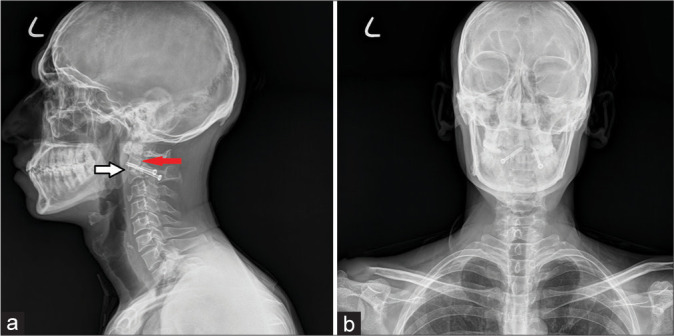 Figure 4: