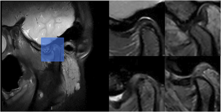 FIGURE 3