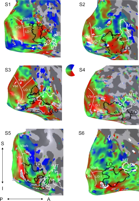 FIG. 4.