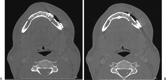 Figure 18