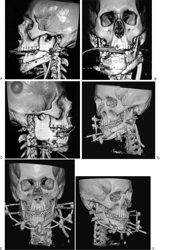 Figure 16