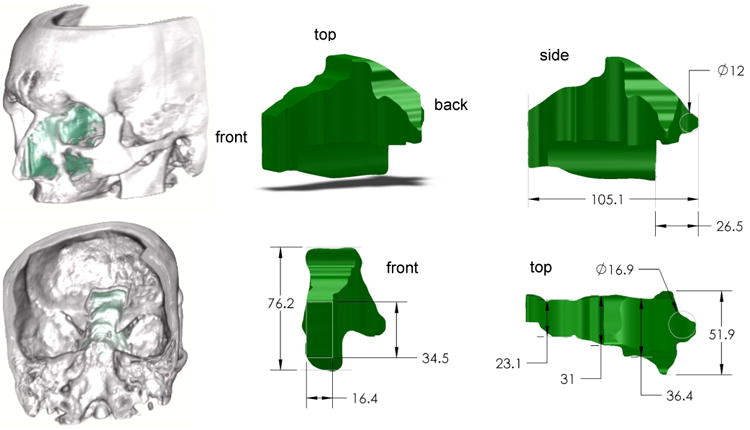 Fig. 4